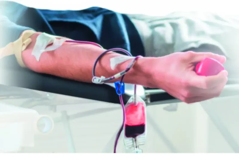 En person bruger Hæmokromatose-sættet (DNA-elektroforese) og donerer blod med en synlig nål, slange og opsamlingspose.