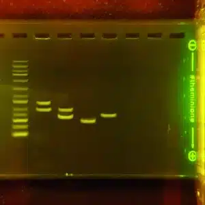 En AMEL-genudviklingskit (DNA-elektroforese)-gel viser en DNA-stige og prøvebånd på en gulfarvet agarosegel.