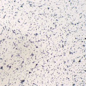 Bakteriologi har en hvid overflade med mørkeblå og sorte pletter, der ligner bakterier under et mikroskop.