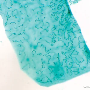 Nærbillede af en gennemskinnelig blå løgcelle under et mikroskop, der viser cellevægge, omtalt i Bakteriologi.