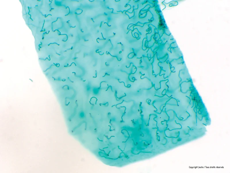 575599_nostoc_ecrasement_1_b336 - LabDidakt.dk Nærbillede af en gennemskinnelig blå løgcelle under et mikroskop, der viser cellevægge, omtalt i Bakteriologi.