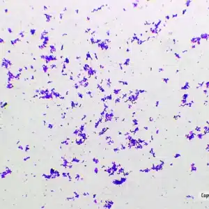 Klynger af Streptokokker er synlige på et Forberedelsesglas mod en hvid baggrund under mikroskopet.