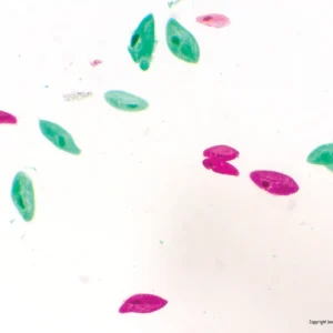 Mikroskopisk billede af flere grønne og pink Protozoer-parasitter spredt på en hvid baggrund.