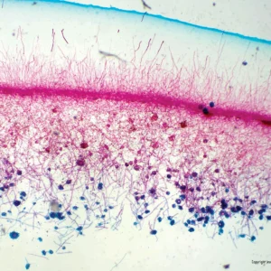 Mikroskopisk billede af Forberedelsesglas: Sterigmatocystin viser tætte lyserøde og blå celler på en hvid baggrund.