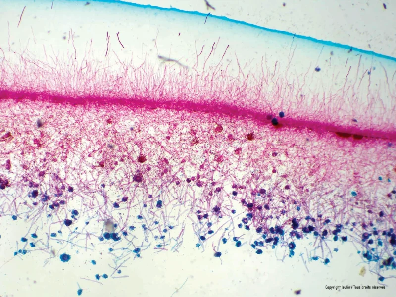 Aspergillace_aspergillus_575093_1_cce7 - LabDidakt.dk Mikroskopisk billede af Forberedelsesglas: Sterigmatocystin viser tætte lyserøde og blå celler på en hvid baggrund.