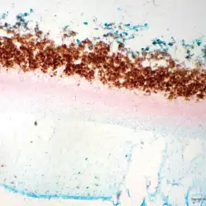 Mikroskopisk billede af Forberedelsesglas: Penicillium, Con viser tætte brune, tynde rosa og blåfarvede fibrøse områder på hvid baggrund.