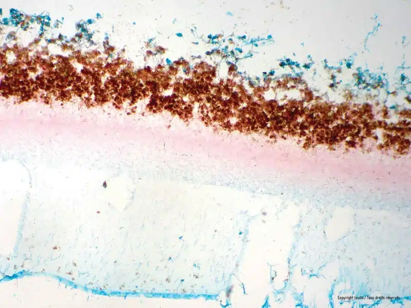 Aspergillace_penicillium_575094_1_11c2 - LabDidakt.dk Mikroskopisk billede af Forberedelsesglas: Penicillium, Con viser tætte brune, tynde rosa og blåfarvede fibrøse områder på hvid baggrund.