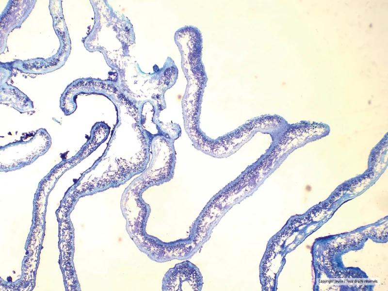Mikroskopisk billede af Mikroskopiske præparater: Lav - Lichen peltigera, ufarvet thallus vævsafsnit.