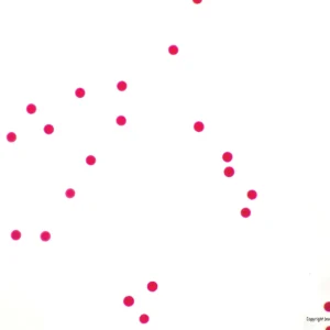 Små røde prikker på ensfarvet hvid baggrund, "Forberedelsesslide: Søpindsvinæg" i nederste højre hjørne.