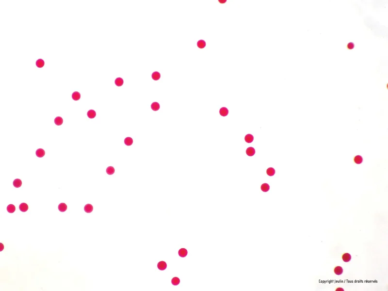 Små røde prikker på ensfarvet hvid baggrund, "Forberedelsesslide: Søpindsvinæg" i nederste højre hjørne.