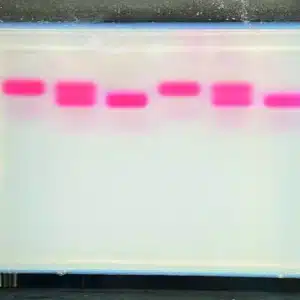 Et Seglcelleanæmi-kit med analoge hæmoglobiner viser lyserøde bånd i hver bane på en gennemskinnelig gel i gelelektroforese.
