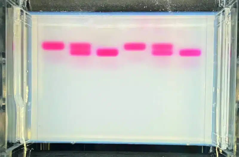 Et Seglcelleanæmi-kit med analoge hæmoglobiner viser lyserøde bånd i hver bane på en gennemskinnelig gel i gelelektroforese.