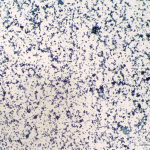 Mikroskopisk billede af blå og lilla farvede Stafylokokker på Forberedelsesglas mod en lys baggrund.