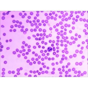 Hurtig farvning af blod