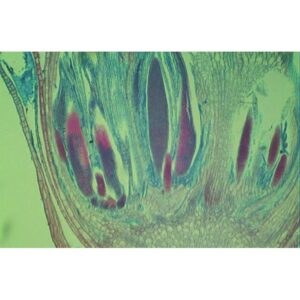 Mikroskopisk billede af et tværsnit af en Bryophytter-stængel, der viser karbundter farvet grønt, rødt og lilla.