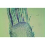 Mikroskopisk billede af Bryophytter-rodspids med blågrønt farvede dækceller og langstrakte rodhår.