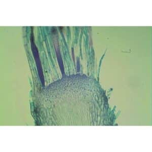 Mikroskopisk billede af Bryophytter-rodspids med blågrønt farvede dækceller og langstrakte rodhår.