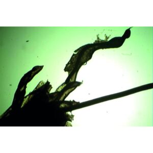 Nærbillede af mikroskopiske præparater: Pteridofytter - Hele mosset med sporogonium under green-lit mikroskopi.