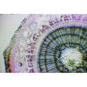 Mikroskopiske præparater: Gymnospermer - Fyrrestamme