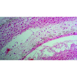 Mikroskopiske præparater: Gymnospermer - Hun-fyrreskæl (2. år) passerer gennem Archegona