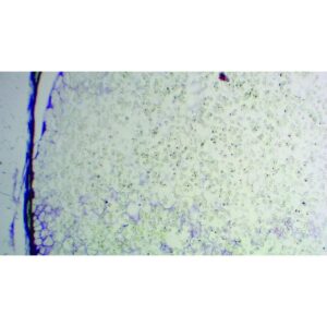 Mikroskopiske præparater: Angiospermer - Ricinusolie