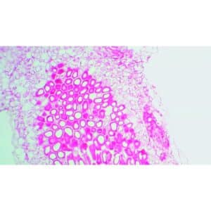 Mikroskopiske præparater: Angiospermer - Knuder på bælgplanternes rødder