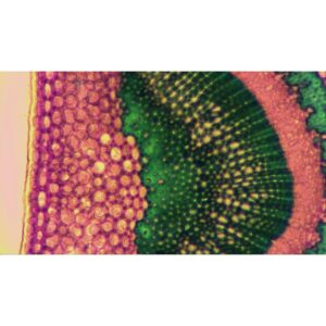 Mikroskopiske præparater: Angiospermer - Klorofylparenkym med kloroplaster (kristtorn- eller berberisblad)