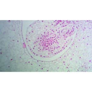 Mikroskopiske præparater: Angiospermer - Aksial placentation (lilje æggestok)