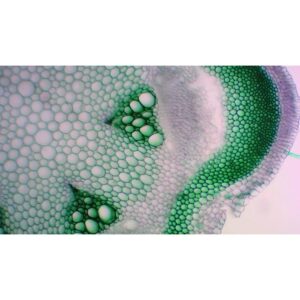 Mikroskopiske præparater: Angiospermer - Sekundær bredbladet stængel, diskontinuerlig vaskulær struktur (clematis eller aristolochus)