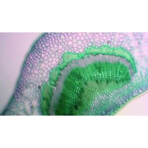 Mikroskopiske præparater: Angiospermer - Kristtorn (vigtigt kutikula og klorofylparenkym)