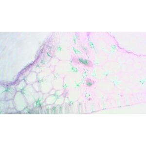 Mikroskopiske præparater: Angiospermer - Åkande (tilpasning til vandmiljøet, skleritter)