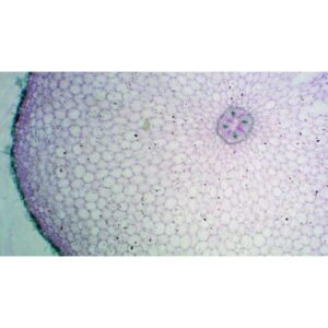 Mikroskopiske præparater: Angiospermer - Ficaria