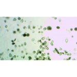 Mikroskopisk billede af Forberedelsesobjektglas: Radiolaria (mange) spredt ud over en lys baggrund.