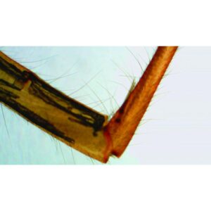 Nærbillede af Forberedelsesrutschebane: Edderkop S-ben joint under et mikroskop, der fremhæver fine hår og segmenter.