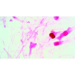 Lyserøde og lilla hyfer og sporer af Zygohrynchus, Muc på en lys baggrund, set under mikroskop.