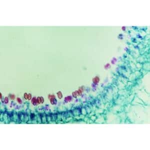 Mikroskopisk billede af Svampe, der viser celler med røde og lilla farvede kerner på en buet grøn struktur.