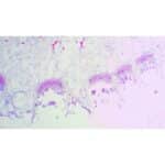 Mikroskopisk billede af Prep. Slide: Teleutosporer af viser bølgede lag af lyserøde og lilla farvede celler i vævsprøven.