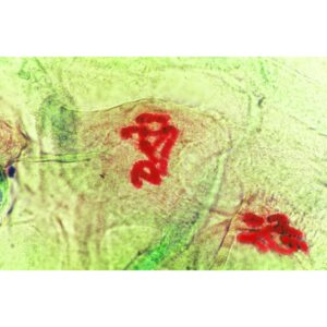 Mikroskopisk billede af Insekter, der viser rødfarvede kromosomer mod en grøn baggrund under celledeling.