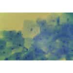 Bakteriologi: Mikroskopisk billede af blåfarvede humane kindceller, der viser kerner under et lysmikroskop.