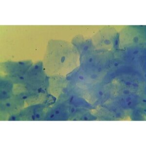 Bakteriologi: Mikroskopisk billede af blåfarvede humane kindceller, der viser kerner under et lysmikroskop.