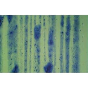 Blå striber og pletter dukker op på en grønlig overflade og minder om de videnskabelige mønstre, man ser i Bakteriologi.