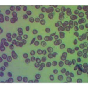 Mikroskopiske præparater: Opskæring af ungt pattedyr - Seglcelleanæmi