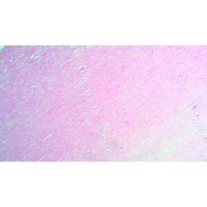 Mikroskopiske præparater: Opskæring af ungt pattedyr - Aterom i den menneskelige aorta