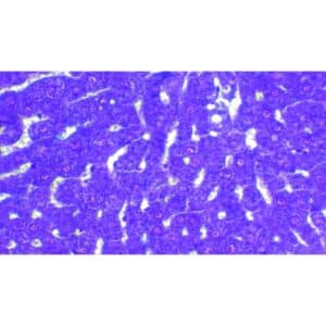 Mikroskopiske præparater: Opskæring af ungt pattedyr - Diabetisk rottelever