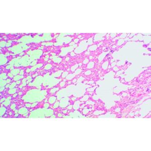 Mikroskopiske præparater: Opskæring af ungt pattedyr - Menneskelig lunge