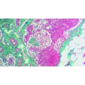 Mikroskopiske præparater: Lymfesystemet - Lymfeknude