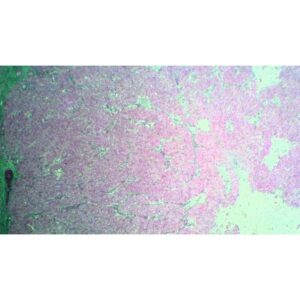 Mikroskopiske præparater: Histologi af hvirveldyr - Æggestok (corpus luteum)