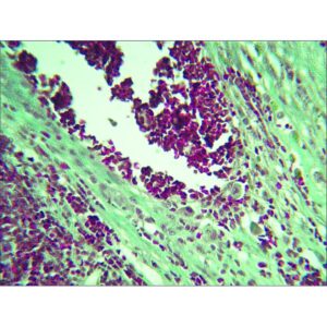 Mikroskopiske præparater: Histologi af hvirveldyr - Hæmangiosarkom (hund)