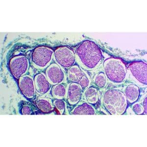 Mikroskopiske præparater: Histologi af hvirveldyr - Kanin-nerve