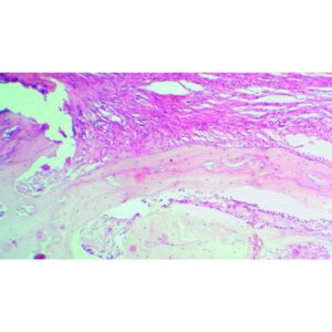 Mikroskopiske præparater: Opskæring af ungt pattedyr - Rød knoglemarvsudstrygning